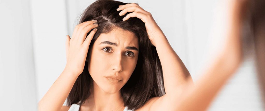 como evitar la caspa